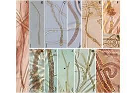 Attēlu rezultāti vaicājumam “Cyanophyta”
