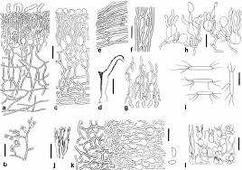 Attēlu rezultāti vaicājumam “Craterocolla cerasi”