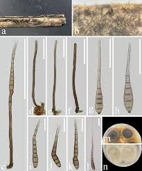 Attēlu rezultāti vaicājumam “Rosellinia desmazieri spores”