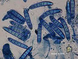 Attēlu rezultāti vaicājumam “Comatricha pulchella spores”