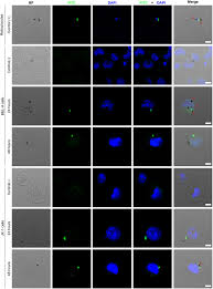 Attēlu rezultāti vaicājumam “Reticularia lobata plasmodium”