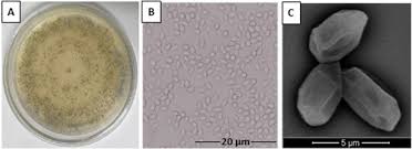 Attēlu rezultāti vaicājumam “Trichia ambigua spores”