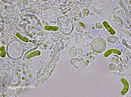 Attēlu rezultāti vaicājumam “Chaenotheca trichialis”