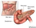 <b>Pancreatitis</b>