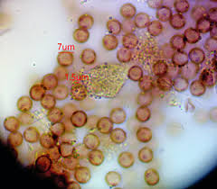 Attēlu rezultāti vaicājumam “Physarum penetrale macro”