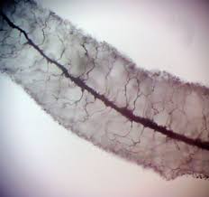 Attēlu rezultāti vaicājumam “Stemonitopsis aequalis var. microspora spores”