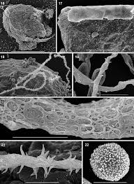 Attēlu rezultāti vaicājumam “Perichaena corticalis spores”