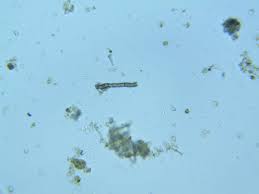 Attēlu rezultāti vaicājumam “Hyaloscypha hyalina”