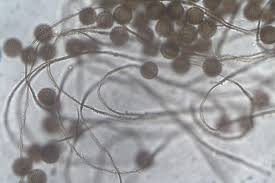 Attēlu rezultāti vaicājumam “Colloderma robustum macro”