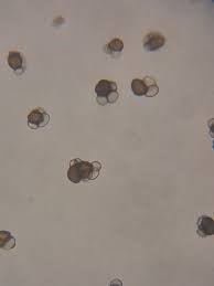 Attēlu rezultāti vaicājumam “Urocystis anemones spores”