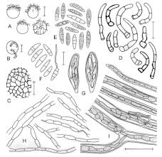 Attēlu rezultāti vaicājumam “Jamesoniella autumnalis sporophyte”