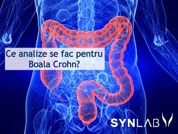 Image result for boala crohn si schizofrenie paranoida