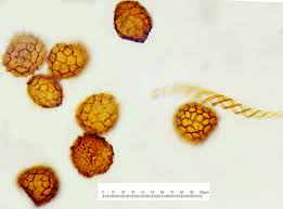 Attēlu rezultāti vaicājumam “Fossombronia foveolata sporophyte”