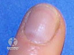 Image result for lunula nail
