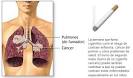 Los <b>carcinógenos</b> son