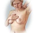 http://lh6.ggpht.com/_6NP3mXgkbPc/TRt6_ULRGhI/AAAAAAAACYE/7_MjynUv7Bg/breast_self_exam.jpg