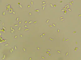 Attēlu rezultāti vaicājumam “Holwaya mucida”