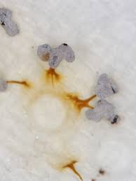 Attēlu rezultāti vaicājumam “Physarum decipiens spores”