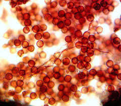 Attēlu rezultāti vaicājumam “Diderma crustaceum macro”