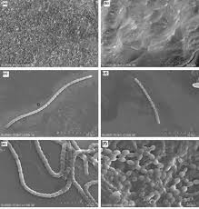 Attēlu rezultāti vaicājumam “Nostoc commune cells”