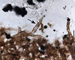 Attēlu rezultāti vaicājumam “Melanospora lagenaria”