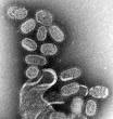 Influenza - eNotes.com Reference