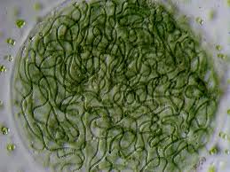 Attēlu rezultāti vaicājumam “Nostoc pruniforme cells”