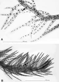 Attēlu rezultāti vaicājumam “Blepharostoma trichophyllum sporophyte”