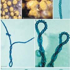 Attēlu rezultāti vaicājumam “Arcyria denudata spores”
