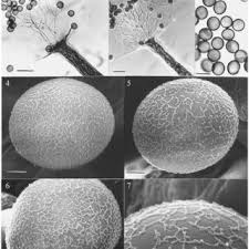 Attēlu rezultāti vaicājumam “Physarum, Nannengaella sp.”