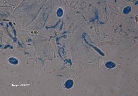 Attēlu rezultāti vaicājumam “Evernia divaricata”