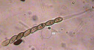 Attēlu rezultāti vaicājumam “Daldinia concentrica”