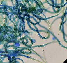 Attēlu rezultāti vaicājumam “Trichia crateriformis stalked”