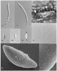 Attēlu rezultāti vaicājumam “Ombrophila violacea spores”