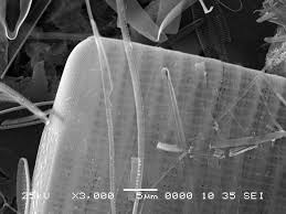 Attēlu rezultāti vaicājumam “Diderma radiatum macro”