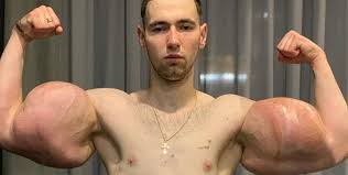 Image result for SYNTHOL