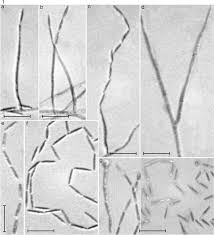 Attēlu rezultāti vaicājumam “Trichia erecta stalked”