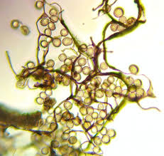 Attēlu rezultāti vaicājumam “Symphytocarpus trechisporus macro”