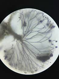 Attēlu rezultāti vaicājumam “Lamproderma elasticum spores”