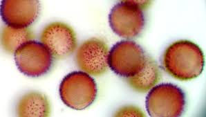 Attēlu rezultāti vaicājumam “Cribraria rubiginosa spores”