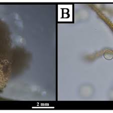 Attēlu rezultāti vaicājumam “Oligonema flavidum spores”