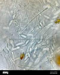 Attēlu rezultāti vaicājumam “Cudoniella acicularis”