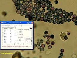 Image result for Podoscypha multizonata