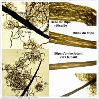 Attēlu rezultāti vaicājumam “Paradiacheopsis rigida spores”