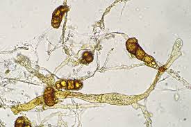 Attēlu rezultāti vaicājumam “Didymodon fallax var. brevifolius”