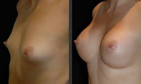 http://t0.gstatic.com/images?q=tbn:ANd9GcQw4gJ1Vk8t4oKcEAa5wIPwDiY6plt37-v92Vs_Q_yR28Vfiq00gg