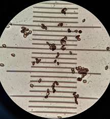 Attēlu rezultāti vaicājumam “Stemonitis marjana spores”