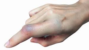 Znalezione obrazy dla zapytania palec