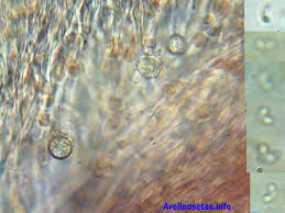 Attēlu rezultāti vaicājumam “Sidera lenis”