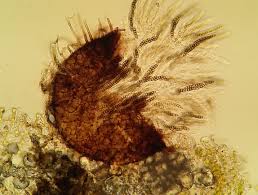 Attēlu rezultāti vaicājumam “Octosporella jungermanniarum”